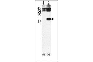 Image no. 1 for anti-beta-2-Microglobulin (B2M) (C-Term) antibody (ABIN357932)