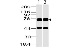Image no. 1 for anti-DEAD (Asp-Glu-Ala-Asp) Box Polypeptide 18 (DDX18) (AA 20-300) antibody (ABIN5027137) (DDX18 antibody  (AA 20-300))