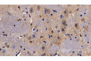 Immunohistochemistry (IHC) image for anti-Neuropeptide S (NPS) (AA 26-89) antibody (ABIN7432625)