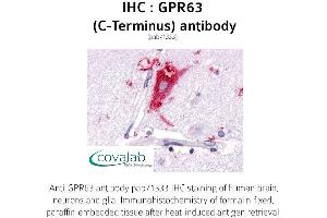 Image no. 1 for anti-G Protein-Coupled Receptor 63 (GPR63) (C-Term) antibody (ABIN1735144) (GPR63 antibody  (C-Term))