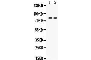 Western blot analysis of ZP2 expression in HELA whole cell lysates (lane 1) and HEPG2 whole cell lysates (lane 2).