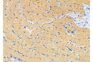 ABIN6266284 and ABIN6277438 at 1/100 staining Rat muscle tissue by IHC-P. (TPM2 antibody  (C-Term))