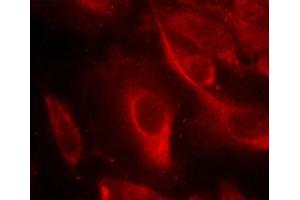 Immunofluorescence staining of methanol-fixed Hela cells showing cytoplasmic staining using MKK6(Phospho-Ser207) Antibody. (MAP2K6 antibody  (pSer207))