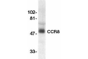 Western Blotting (WB) image for anti-Chemokine (C-C Motif) Receptor 8 (CCR8) antibody (ABIN2472922)