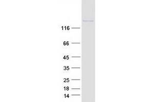 Validation with Western Blot