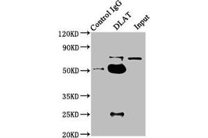 Immunoprecipitating DLAT in HepG2 whole cell lysate Lane 1: Rabbit control IgG instead of ABIN7149908 in HepG2 whole cell lysate. (DLAT antibody  (AA 26-217))