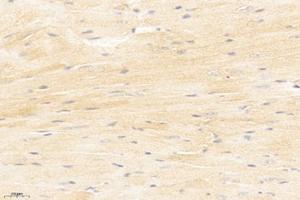 Immunohistochemistry analysis of paraffin-embedded mouse heart using,MYLK3 (ABIN7074736) at dilution of 1: 1200 (MYLK3 antibody)