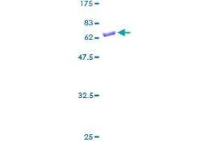 SULT1B1 Protein (AA 1-296) (GST tag)