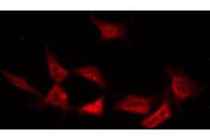 ABIN6267619 staining NIH-3T3 by IF/ICC. (PKC delta antibody  (pTyr64))