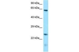 Image no. 1 for anti-Runt-Related Transcription Factor 1, Translocated To, 1 (Cyclin D-Related) (RUNX1T1) (N-Term) antibody (ABIN6748227) (RUNX1T1 antibody  (N-Term))