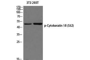 Western Blot (WB) analysis of 3T3 293T using p-Cytokeratin 18 (S52) antibody. (Cytokeratin 18 antibody  (pSer52))