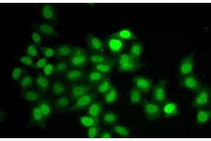 Immunofluorescence analysis of U2OS cells using MAD1L1 Polyclonal Antibody