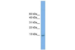 WB Suggested Anti-KRTAP23-1 Antibody Titration:  0.