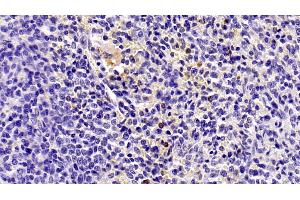 Detection of IL8 in Human Spleen Tissue using Monoclonal Antibody to Interleukin 8 (IL8) (IL-8 antibody  (AA 28-99))