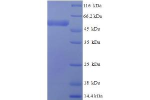 SDS-PAGE (SDS) image for Isocitrate Dehydrogenase 3 (NAD+) gamma (IDH3G) (AA 40-393) protein (His-SUMO Tag) (ABIN4976171)