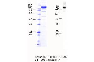 Western Blotting (WB) image for Cadherin 18, Type 2 (CDH18) (AA 54-608) protein (MBP tag) (ABIN3090475) (CDH18 Protein (AA 54-608) (MBP tag))