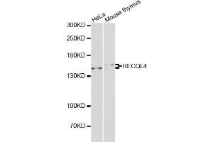 Western blot analysis of extracts of various cell lines, using RECQL4 antibody. (RECQL4 antibody)