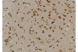 ABIN6277006 at 1/100 staining Human brain tissue by IHC-P. (PSMD2 antibody  (C-Term))