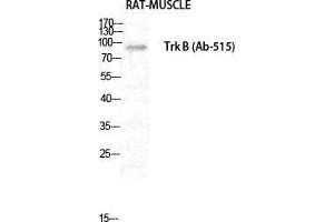Western Blot (WB) analysis of Rat Muscle cells using Trk B Polyclonal Antibody. (TRKB antibody  (Thr185))