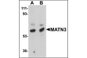Western blot analysis of MATN3 in rat thymus tissue lysate with this product at (A) 1 and (B) 2 μg/ml. (Matrilin 3 antibody  (Center))
