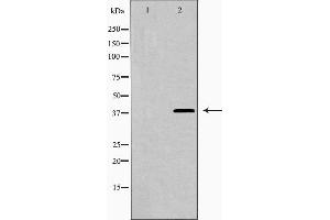 Western blot analysis of LEG9 expression in HepG2 cells,The lane on the left is treated with the antigen-specific peptide.