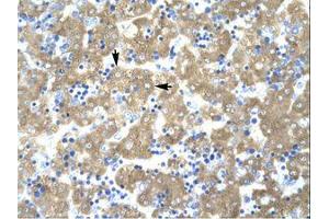 Image no. 1 for anti-Acetyl-CoA Acetyltransferase 2 (ACAT2) (AA 174-223) antibody (ABIN202424) (ACAT2 antibody  (AA 174-223))