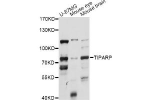 Western blot analysis of extracts of various cell lines, using TIPARP antibody (ABIN6292494) at 1:1000 dilution. (Tiparp antibody)