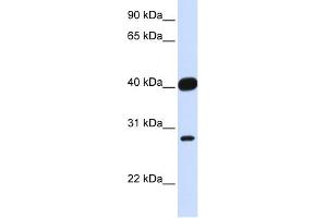 WB Suggested Anti-ELK3 Antibody Titration:  0. (ELK3 antibody  (Middle Region))