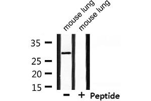 Western blot analysis of extracts from mouse lung, using RNF144A Antibody. (RNF144A antibody  (Internal Region))