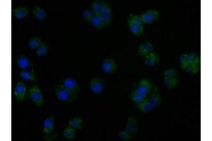 Immunofluorescence staining of PC3 cells with ABIN7140185 at 1:50, counter-stained with DAPI. (TGFBR3L antibody  (AA 242-258))