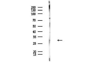 anti-Surfeit 1 (SURF1) (Internal Region) antibody