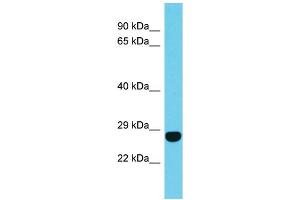Host: Rabbit Target Name: FAM204A Sample Type: Jurkat Whole Cell lysates Antibody Dilution: 1. (FAM204A antibody  (N-Term))