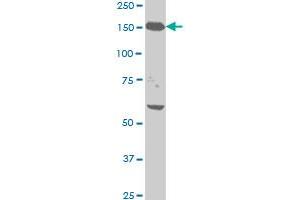 NEFH monoclonal antibody (M01), clone 2E8 Western Blot analysis of NEFH expression in HeLa . (NEFH antibody  (AA 263-363))