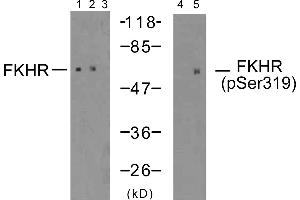 Western blot analysis of extracts using FKHR (Ab-319) antibody (Line 1, 2 and 3) and FKHR (phospho-Ser319) antibody (Line 4 and 5). (FOXO1 antibody  (Ser319))