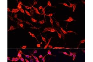 Immunofluorescence analysis of PC-12 cells using ENO3 Polyclonal Antibody at dilution of 1:100. (ENO3 antibody)
