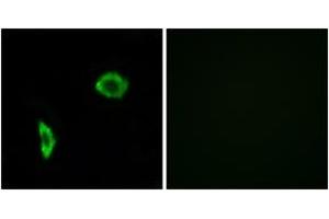 Immunofluorescence analysis of LOVO cells, using Prostacyclin Receptor Antibody.