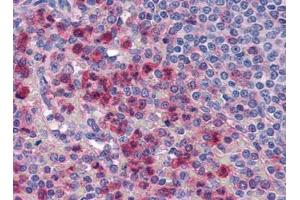 Image no. 1 for anti-Interleukin-27 Subunit alpha (IL27) (Center) antibody (ABIN372920) (IL27 antibody  (Center))