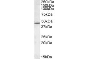 Western Blotting (WB) image for anti-Cholinergic Receptor, Nicotinic, beta 2 (Neuronal) (CHRNB2) (Internal Region) antibody (ABIN2466784) (CHRNB2 antibody  (Internal Region))