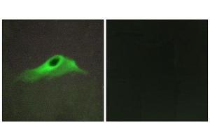 Immunofluorescence (IF) image for anti-Collagen, Type IV, alpha 5 (COL4A5) (N-Term) antibody (ABIN1850286) (COL4a5 antibody  (N-Term))