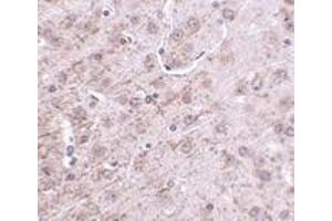 Immunohistochemistry of CRMP-1 in mouse brain tissue with CRMP-1 antibody at 2.