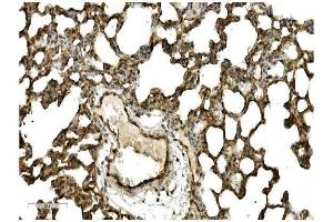 IHC analysis of Caveolin-2/CAV2 using anti Caveolin-2/CAV2 antibody (ABIN7601170). (Caveolin 2 antibody  (AA 3-162))
