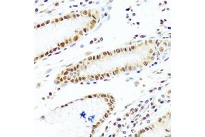 Immunohistochemistry of paraffin-embedded human stomach using PRPF19 antibody. (PRP19 antibody)