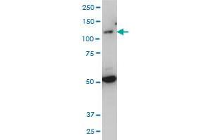 TLR7 monoclonal antibody (M04), clone 2C9 Western Blot analysis of TLR7 expression in IMR-32 . (TLR7 antibody  (AA 27-126))