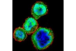Confocal immunofluorescent analysis of Rb antibody with MDA-MB435 cells followed by Alexa Fluor 488-conjugated goat anti-rabbit lgG (green). (Retinoblastoma Protein (Rb) antibody  (AA 586-615))