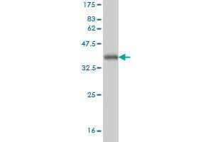 Western Blot detection against Immunogen (36. (TREX1 antibody  (AA 1-100))
