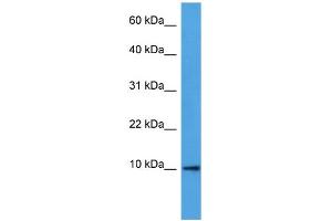 Western Blotting (WB) image for anti-Defensin, beta 4A (DEFB4) (N-Term) antibody (ABIN2788361) (DEFB4A antibody  (N-Term))