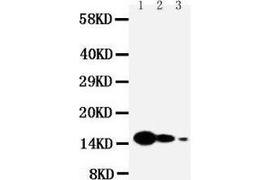 Anti-IL7 antibody, Western blotting Lane 1: Recombinant Mouse IL-7 Protein 10ng Lane 2: Recombinant Mouse IL-7 Protein 5ng Lane 3: Recombinant Mouse IL-7 Protein 2.