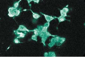 Immunofluorescence staining of PC12 cells (Rat neuroblastoma, ATCC CRL-1721). (DLG4 antibody  (AA 353-504))