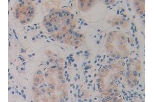 Detection of Slit1 in Human Stomach Tissue using Polyclonal Antibody to Slit Homolog 1 (Slit1) (SLIT1 antibody  (AA 603-773))