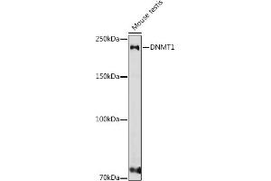 Western blot analysis of extracts of various cell lines, using DNMT1 antibody (ABIN7266810) at 1:1000 dilution. (DNMT1 antibody  (AA 1-270))